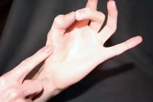 Eine Hand drückt mit einem Finger auf die Fläche der anderen Hand, als ob sie Garstufen von Steaks prüfen würde.