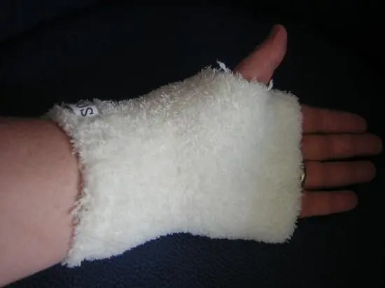 Weiße Socke umfunktioniert zum Hand-Orthesenstrümpfchen, getragen an der linken Hand, auf dunklem Hintergrund.