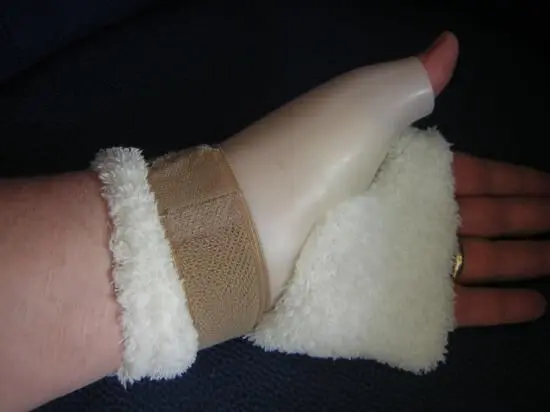 Ein Handgelenkschutz, umfunktioniert von einem Socken, bietet Unterstützung mit einem warmen, weichen Material.