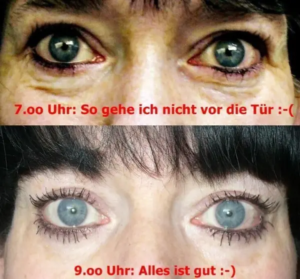 Ein Gesicht zeigt oben geschwollene Augen mit Ringen, unten strahlende, frische Augen. Der Text beschreibt den Unterschied: "7.00 Uhr: So gehe ich nicht vor die Tür :-( 9.00 Uhr: Alles ist gut :-)"