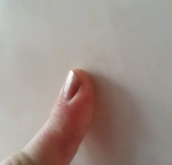 Ein Fingernagel zeigt eine brüchige Stelle, während eine Hand ihn gegen einen weißen Hintergrund hält.