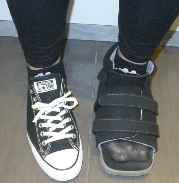 Ein Fuß trägt einen normalen Sneaker, der andere einen speziellen Schuh für Hallux valgus, der stabilisiert und entlastet.