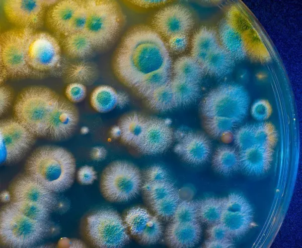 Unter dem Mikroskop sieht Schimmel ganz schön aus. Im Labor wurde das Penicillin entdeckt, das seit 100 Jahren Menschen rettet.