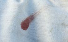 Alte, hartnäckige Blutflecken (außer Fett) mit Backhefe entfernen