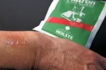 Natron gegen Jucken bei Mückenstichen