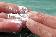 Unterwegs klebrige Haut bei Hitze mit Puder behandeln