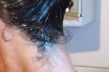 Haarfarbe von der Haut entfernen