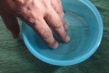 Entzündung an den Nagelbetten - in Mundspülung baden