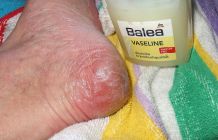 Verhornte Fersen werden über Nacht weich durch Vaseline