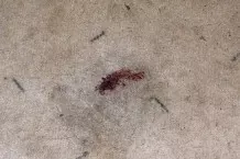 Blutflecken auf dem Teppich?