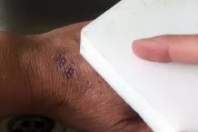 Stempel mit Schmutzradierer von der Hand entfernen