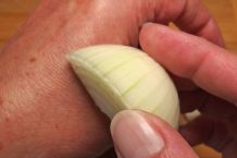 Hilfe bei Insektenstichen