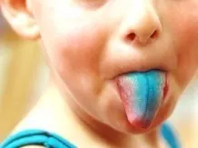 Blaue Zunge nach dem Essen von Waldheidelbeeren?