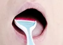 Zungenschaber gegen Mundgeruch