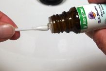 Aphten im Mund behandeln