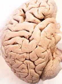 Gegen Zerstreutheit - Tipps für das Trainieren des Gedächtnisses