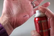 Kugelschreibertinte auf den Händen