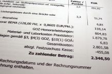 Kosten sparen beim Zahnersatz