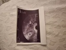 Ultraschallbild dekorativ aufbewahren