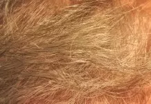 Tipp gegen Haarausfall