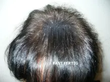 Lichtes Haar/kahle Stellen verdichten und unsichtbar machen