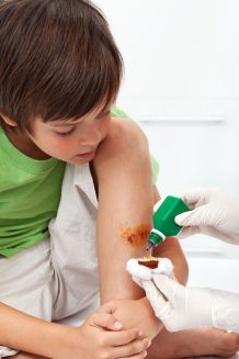 Betaisodona Lösung - Antiseptikum für Haut und Wunden