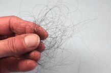 Haarausfall nach Schwangerschaft