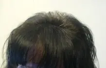 Dünnes & lichtes Haar: "Head & Shoulders Extra Haarverdickendes Tonic"