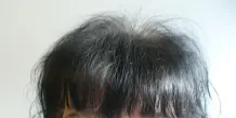Dünnes & lichtes Haar: "Head & Shoulders Extra Haarverdickendes Tonic"