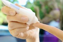 Hirschtalgcreme gegen Herpes und raue Nase