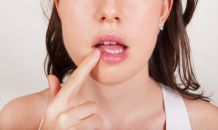 Schüssler-Salze gegen Herpes
