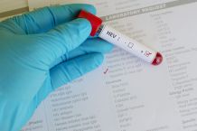 Hepatitis E durch Fleischprodukte: Wie groß ist das Risiko?