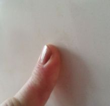 Tipps gegen brüchige Fingernägel