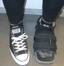 Hallux valgus: Besser laufen durch Vortäuschung falscher Tatsachen
