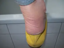 Endlich keine Blasen mehr an den Füßen
