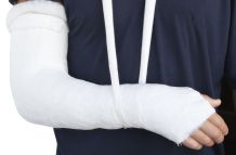 Unfall: Rundumhilfe und Pflege