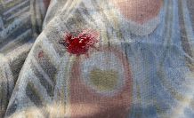 Salz gegen Blutflecken