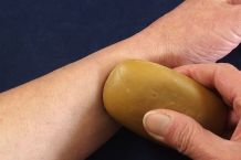 Linderung bei Mückenstichjuckreiz mit Seife oder Speichel