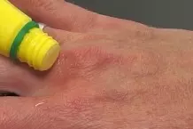 Zitronensaft gegen Mückenstiche