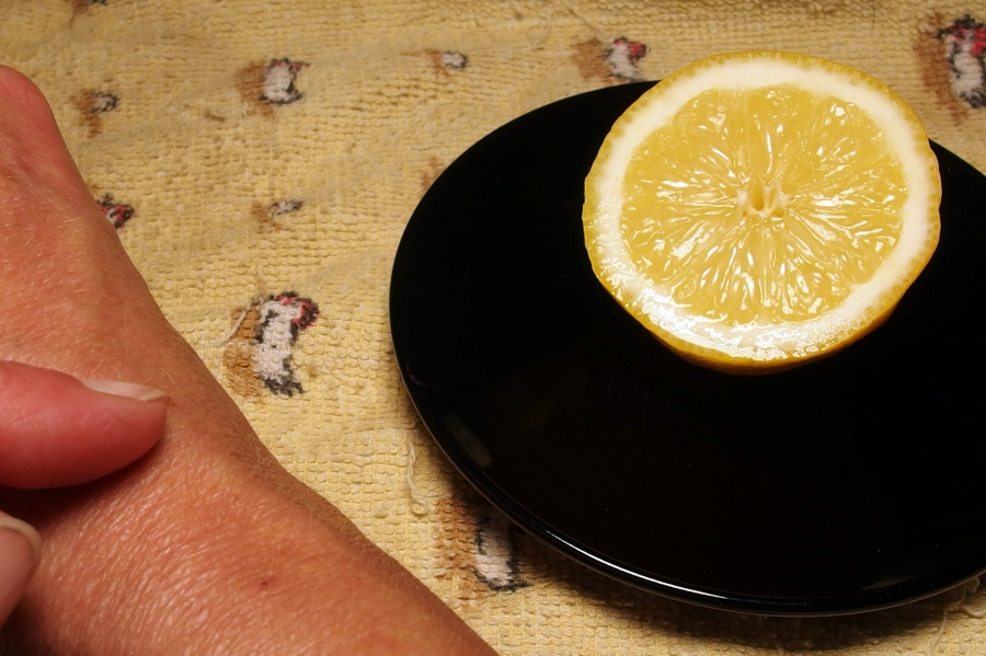 Durch Auftragen von Zitronensaft werden Altersflecken auf Armen und im Gesicht blasser.