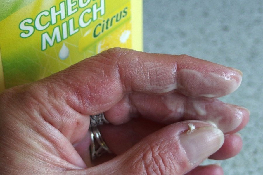 Nikotinablagerungen an Fingern mit Scheuermilch entfernen.