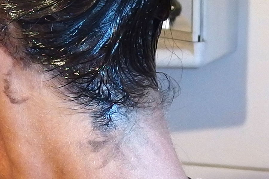 Haarfarbe von der Haut schonend und ohne Rötung der Haut entfernen. So geht's.