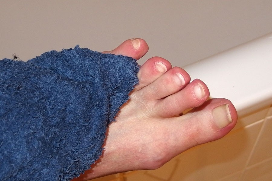 Tipps zum Vorbeugen von Fußpilz: Füße regelmäßig reinigen, pflegen und mehr.