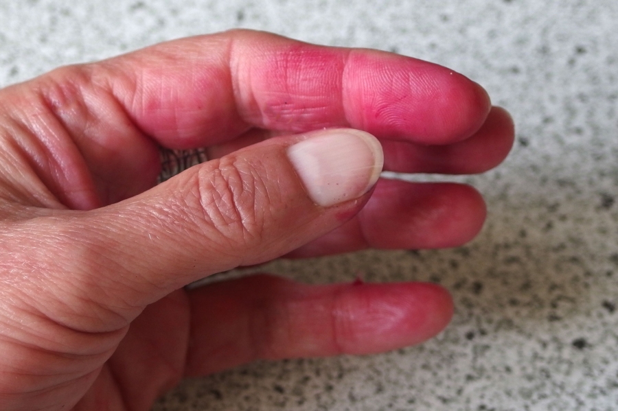 Vitamin C Pulver bei verfärbten Fingern durch Rote Beete: Hilft auch gut bei Selbstbräunungscreme oder anderen natürlichen Färbern.