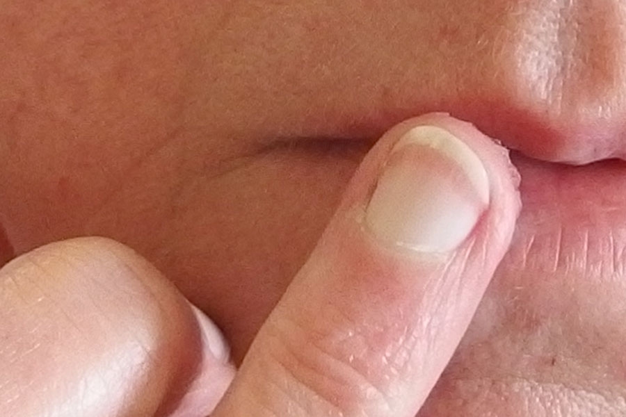 Gegen trockene Lippen hilft Vaseline - diese dünn auftragen, kurz einwirken lassen und restlichen Film entfernen.