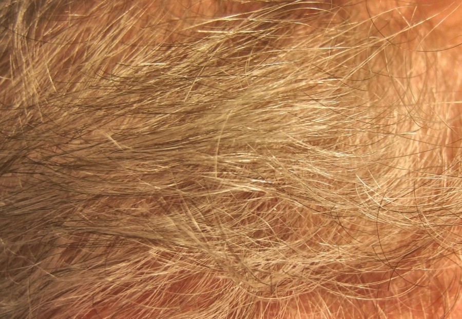 Tipp für mehr Haare und gegen Haarausfall: Kopf nach jedem Waschen mit Brennesseltee einmassieren. 