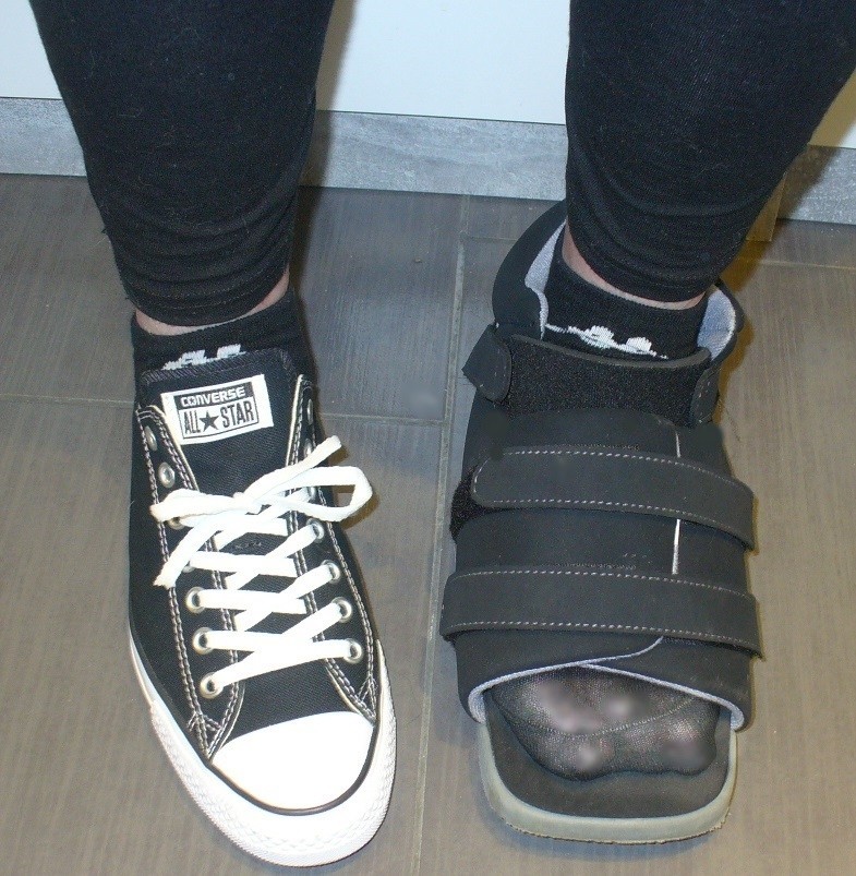 Der Verbandschuh/Gipsschuh ist ein weicher leichter offener Schuh mit diversen Klettverschlüssen, in dem mein Fuß genügend Platz hat, um nicht zu schmerzen und nirgendwo anzustoßen.