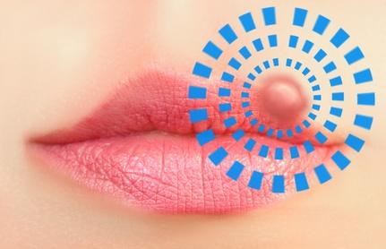 Ballistol gegen Lippenherpes