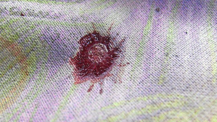 Essig-Waschmittellauge gegen frische Blutflecken auf z. B. Sofas oder Matratzen. Die Lauge hilft auch bei anderen Flecken.