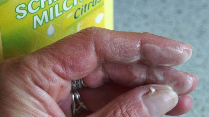 Nikotinablagerungen an Fingern mit Scheuermilch entfernen.